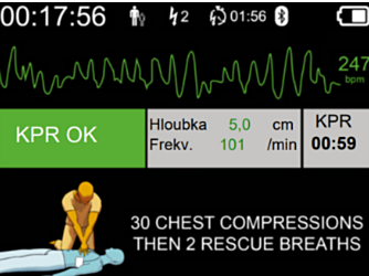 DefiSign Pocket Plus Opzione display ECG  - 11527